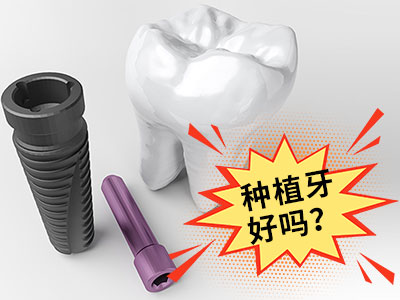 1660091182590658.jpg 画板 20.jpg