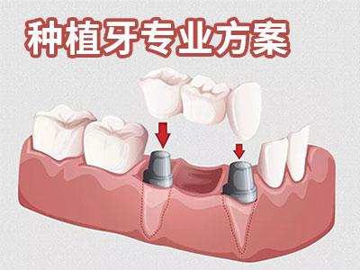 1660091202118367.jpg 画板 29.jpg