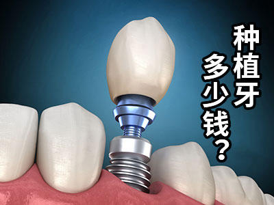 1662597462415573.jpg 画板 14.jpg