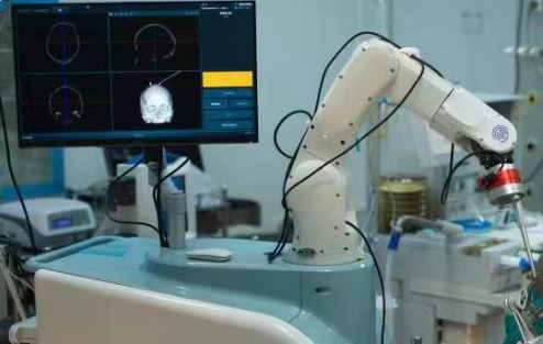 率先开展!3D智能机器人新型超微创减压术精准开展超微创减压术