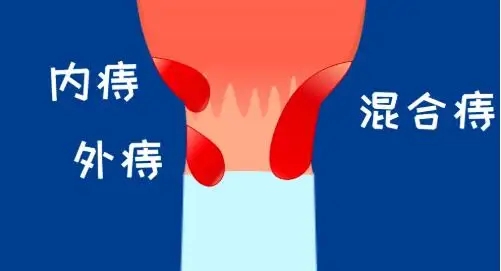 src=http___www.hfzs.com_pic_20210202_20210202152912_86462.jpg&refer=http___www.hfzs.webp.jpg