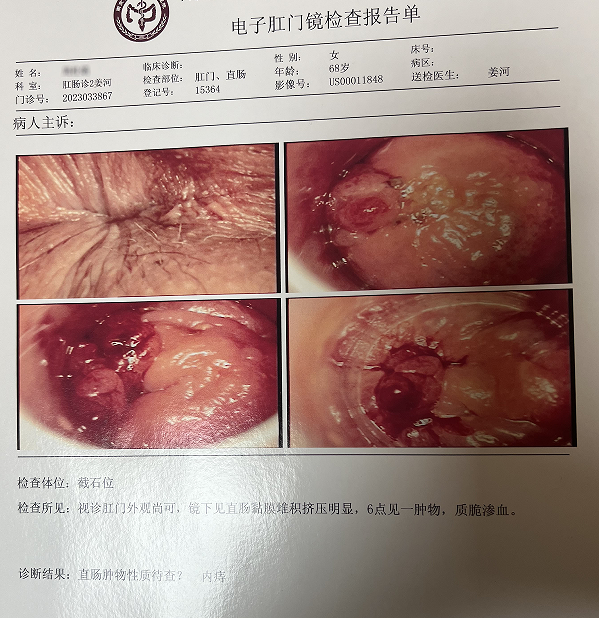 潍坊市肛肠疾病医疗现状与展望