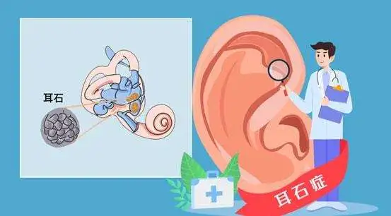 成都民生福音耳鼻喉专科医院！耳鼻喉专科排名第一的医院！