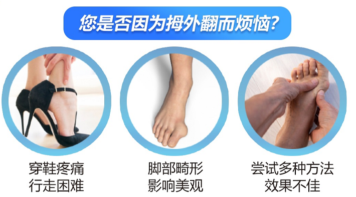 开放手术已成过去式?4月16-17日北京拇外翻专家揭秘3毫米微创新技术