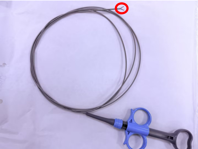 组织夹是什么胃肠镜术后胃里多了“小钛夹”，留在身体里安不安全、还用不用取出来？燕达医院消化科一文说清楚_https://www.jmylbn.com_新闻资讯_第2张