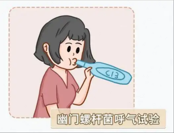 幽门螺杆菌检测 640.png