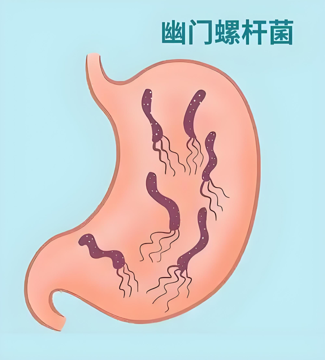幽门螺杆菌23640.png