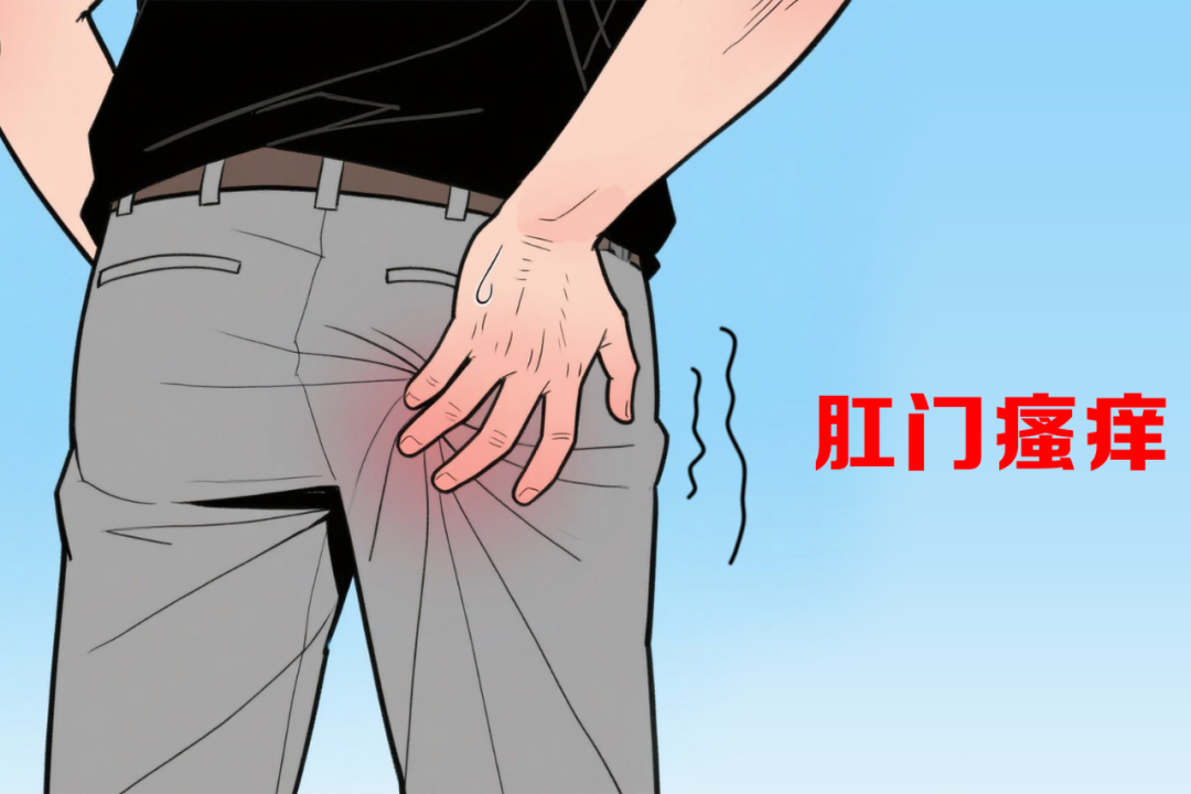 肛门瘙痒42343640.png