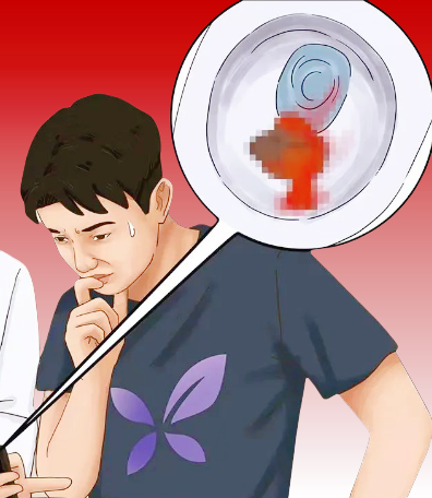 【血便】.png